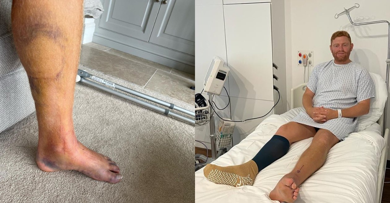 Jonny Bairstow opened up about his leg injury