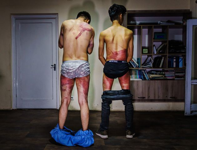 The journalists, Nematullah Naqdi (left) and Taqi Daryabi, said they were beaten with electrical cables, batons and whips